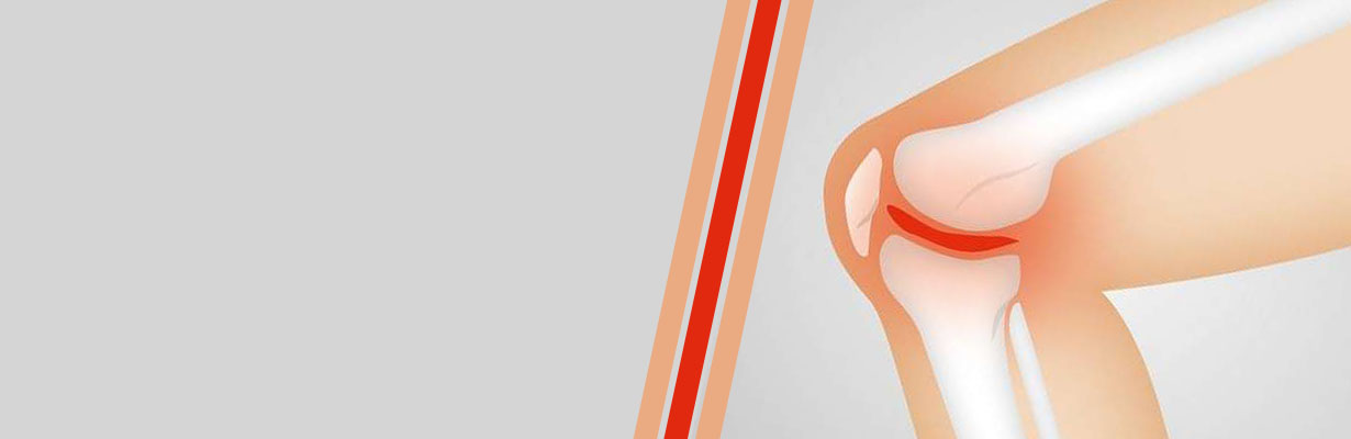 How common is osteoarthritis knee in india?