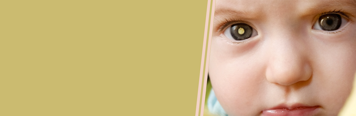 How is cataract managed in children?