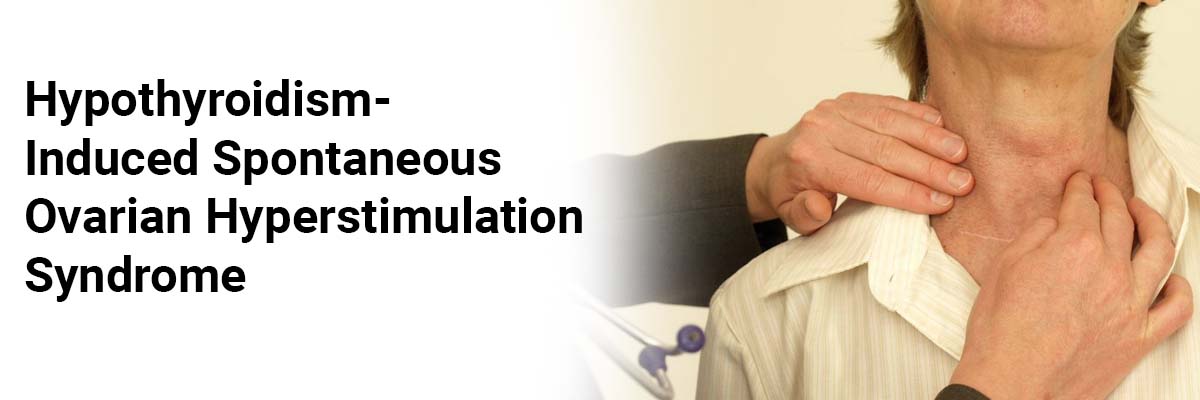 Hypothyroidism-induced spontaneous ovarian hyperstimulation syndrome
