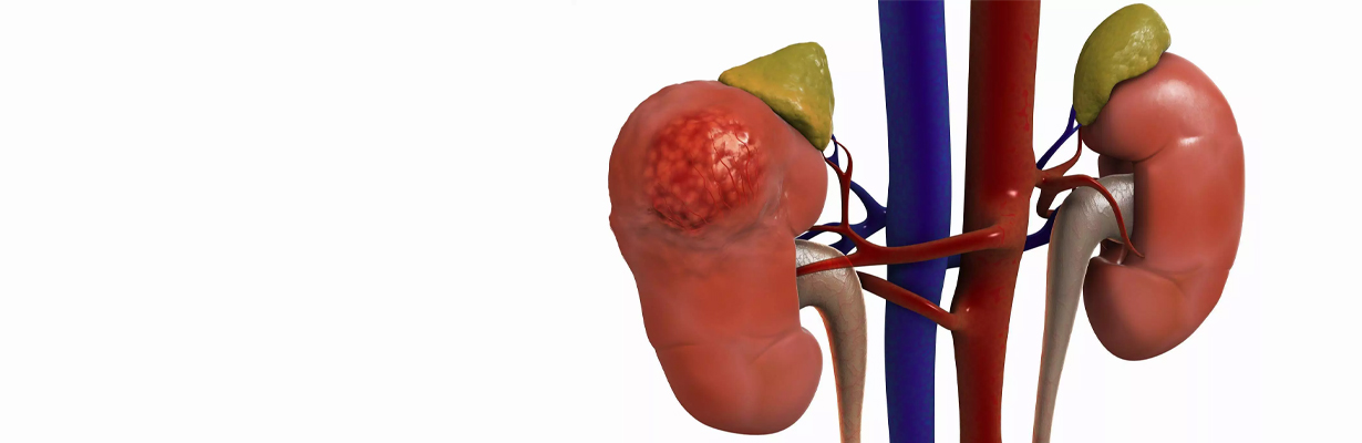 I have heard that probiotics can improve CKD Is it true?