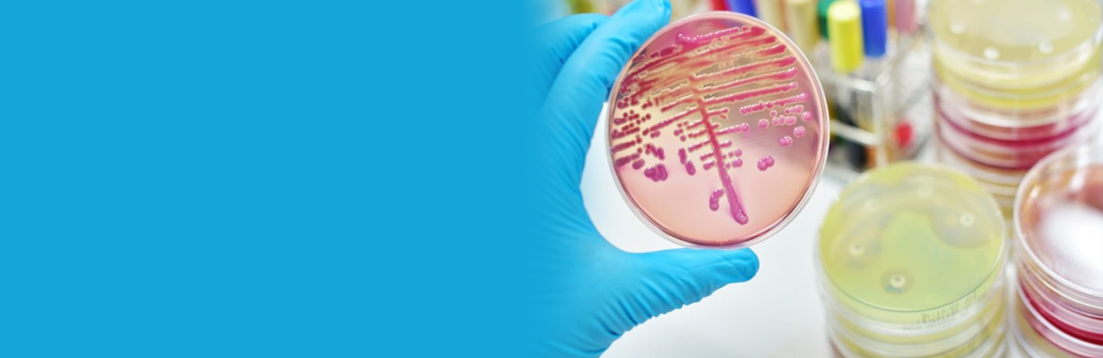 What are the important points to be considered in sepsis and septic shock?