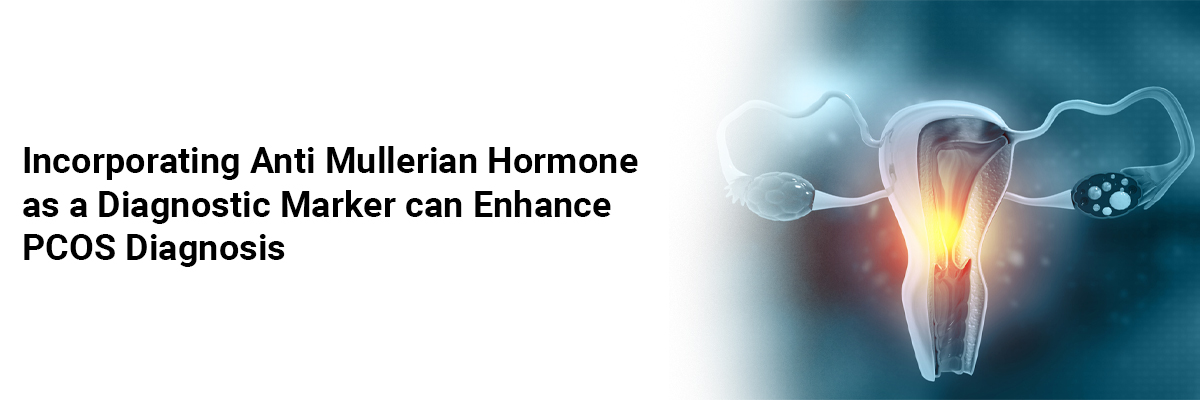 Incorporating Anti Mullerian Hormone as a Diagnostic Marker can Enhance PCOS Diagnosis.