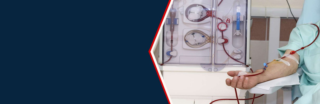 Is dialysis the only option if I develop ESRD?