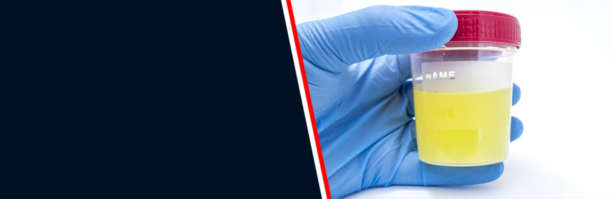 Is smelly urine a sign of diabetes?