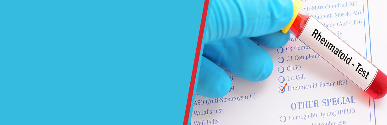 Is Rheumatoid factor a diagnostic test for rheumatoid arthritis?
