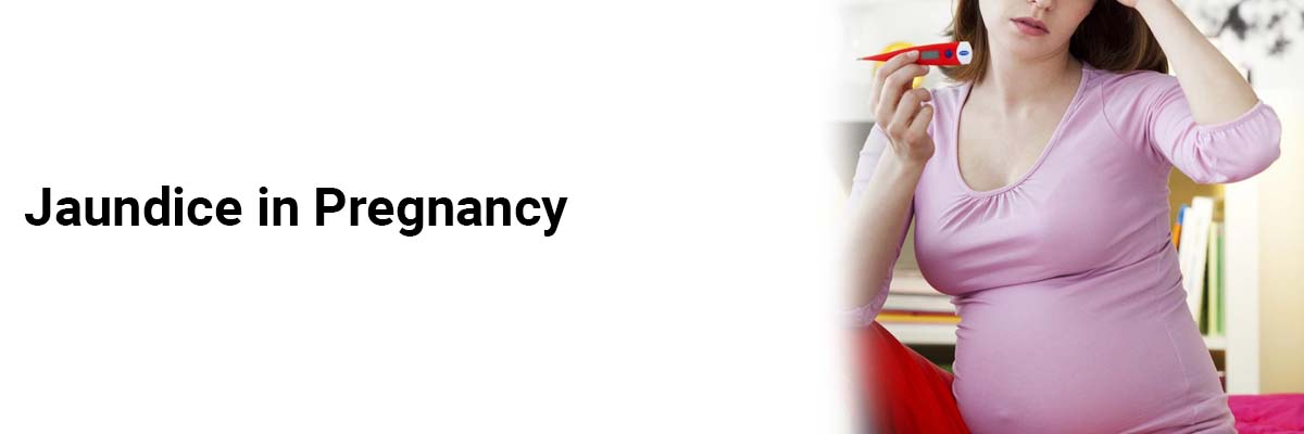 Jaundice in pregnancy