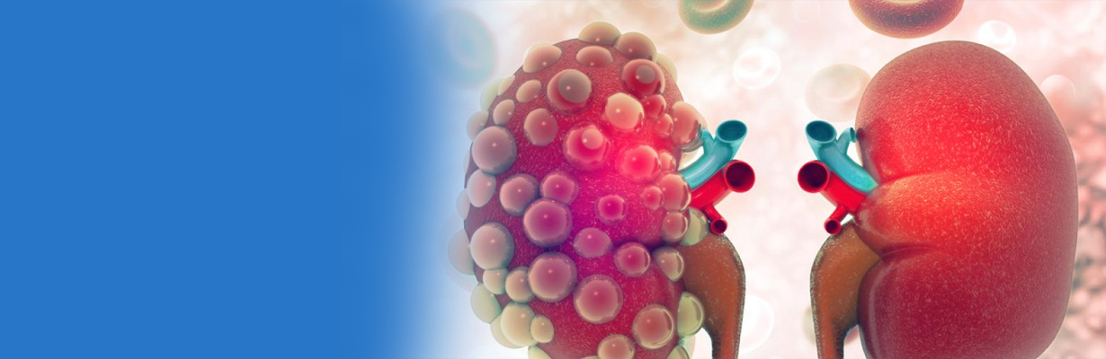 Kidney diseases in diabetes patients?