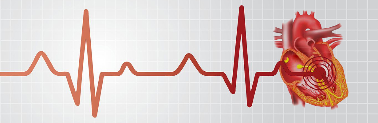 LBB vs RBB: What will you ignore in an ECG?
