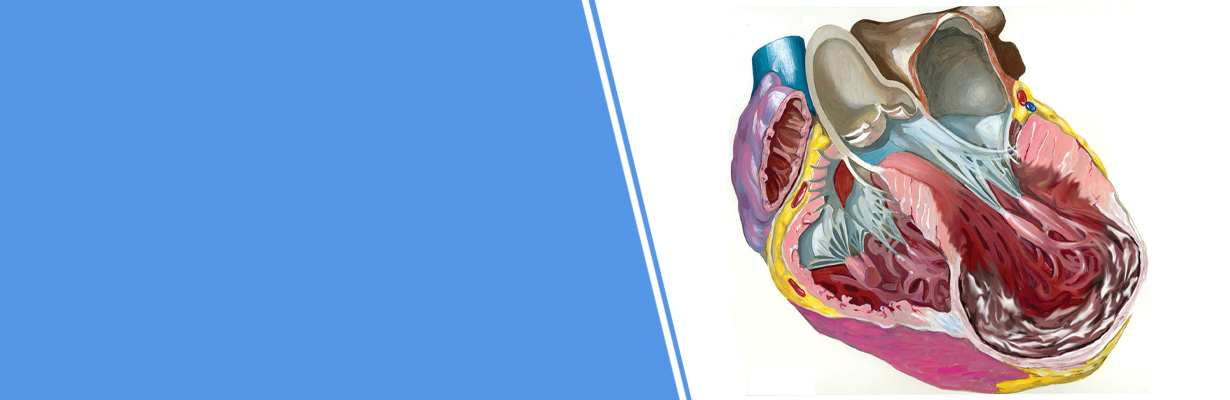 What about bypass surgery with LV volume reduction?