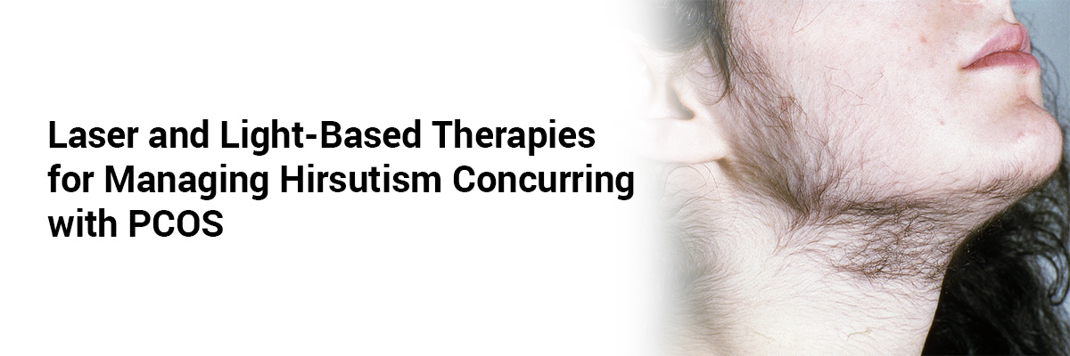 Laser and Light-Based Therapies for Managing Hirsutism Concurring with PCOS