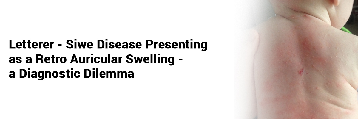 Letterer-siwe disease presenting as a retro auricular swelling-a diagnostic dilemma