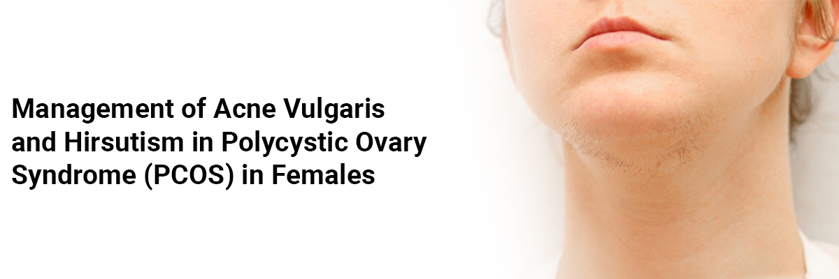 Management of Acne Vulgaris and Hirsutism in Polycystic Ovary Syndrome (PCOS) in Females