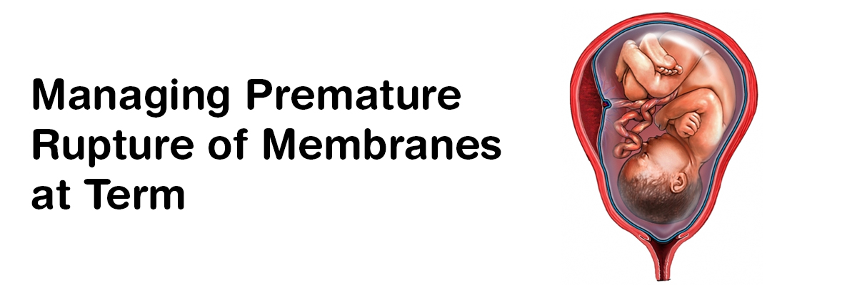 Managing Premature rupture of membranes at term