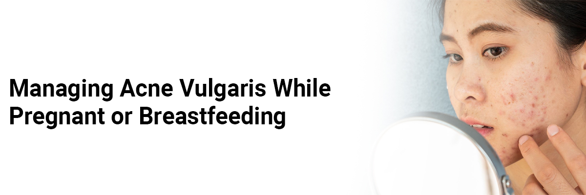 Managing Acne Vulgaris While Pregnant or Breastfeeding