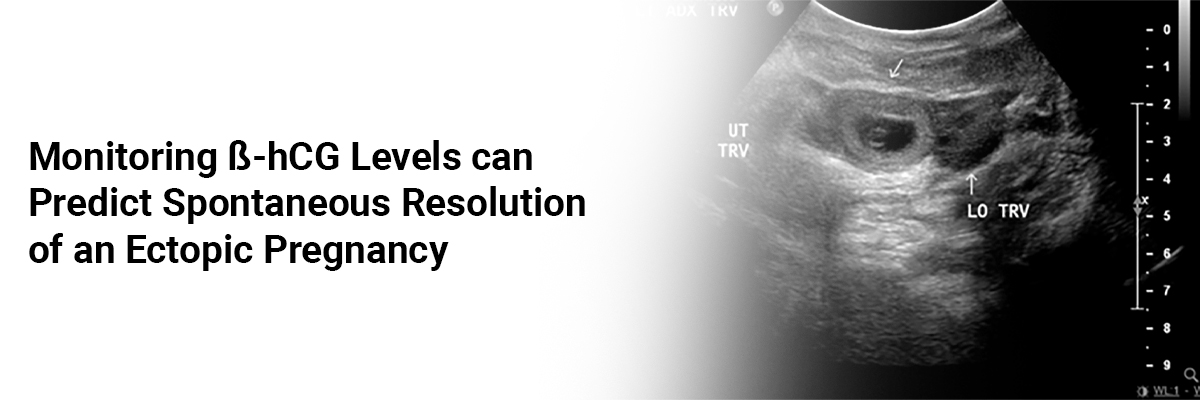 Monitoring ß-hCG levels can predict spontaneous resolution of an ectopic pregnancy