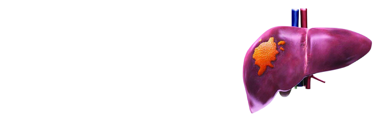 NAFLD and NASH in Risk Group's