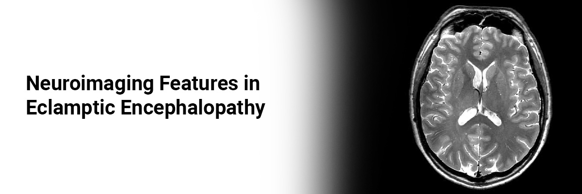 Neuroimaging Features in Eclamptic Encephalopathy