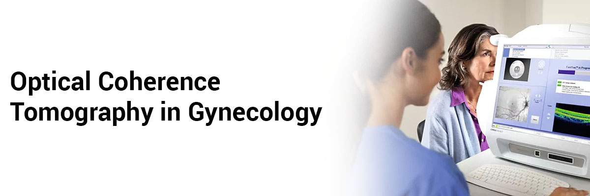 Optical coherence tomography in gynecology