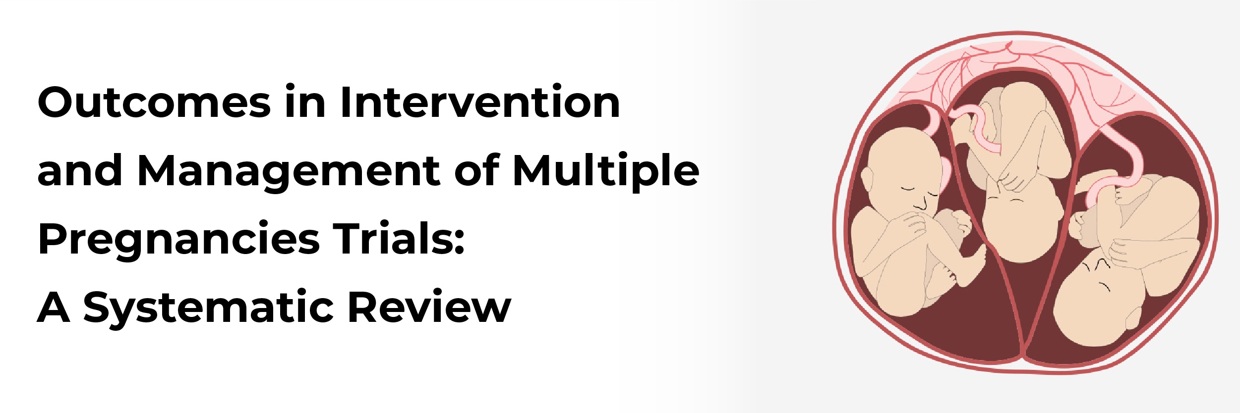 Outcomes in intervention and management of multiple pregnancies trials: A systematic review