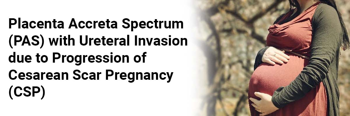 Placenta Accreta Spectrum(PAS) with Ureteral Invasion due to Progression of Cesarean Scar Pregnancy(CSP)