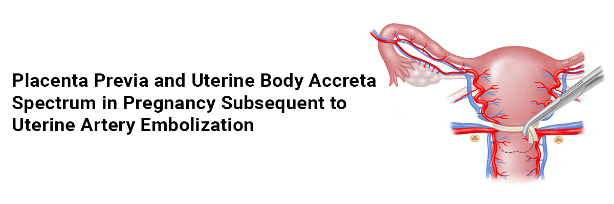 Placenta previa and uterine body accreta spectrum in pregnancy subsequent to uterine artery embolization