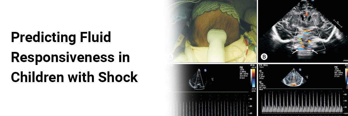 Predicting Fluid Responsiveness in Children with Shock