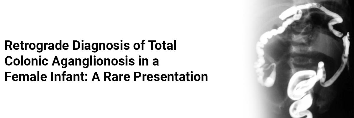 Retrograde diagnosis of total colonic aganglionosis in a female infant: a rare presentation