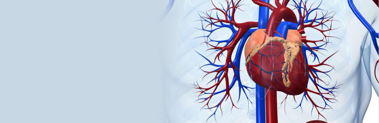 Role of primary PCI in cardiogenic shock in acute MI?