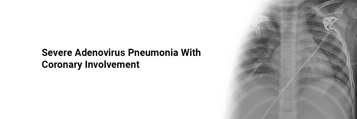 Severe Adenovirus Pneumonia With Coronary Involvement