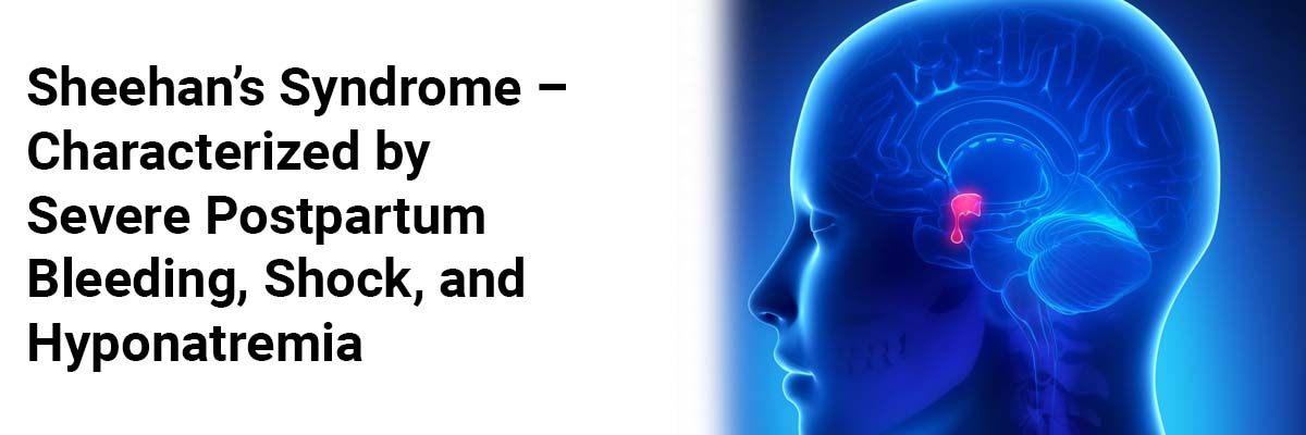 Sheehan’s Syndrome – characterized by severe postpartum bleeding, shock, and hyponatremia