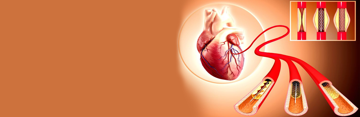 Should angioplasty be performed in coronary artery obstructive disease?