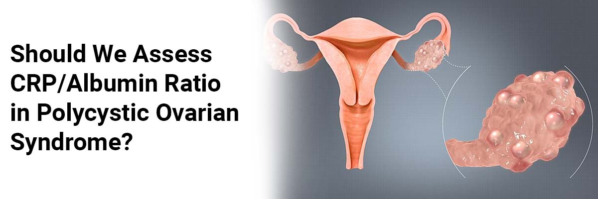 Should We Assess CRP/Albumin Ratio in Polycystic Ovarian Syndrome?