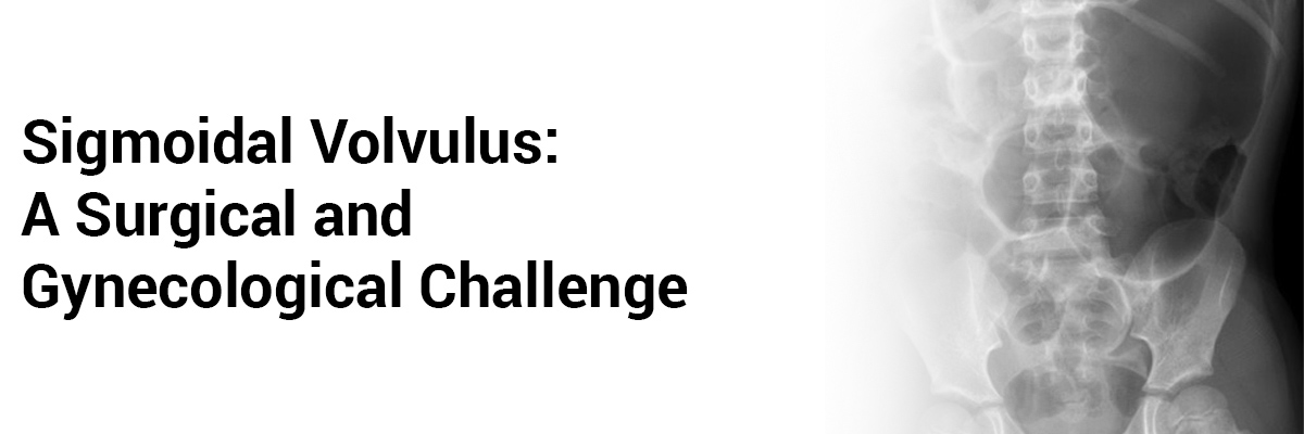 Sigmoidal Volvulus: A Surgical and Gynecological Challenge