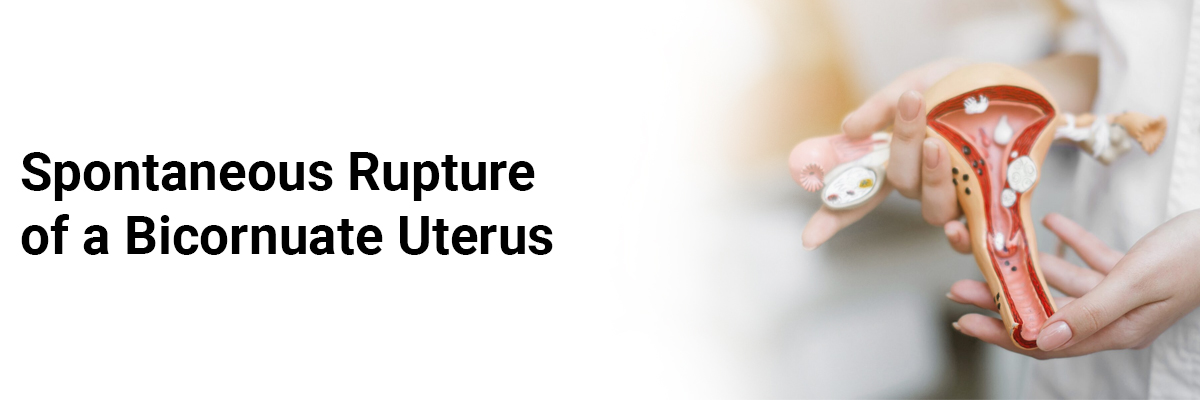 Spontaneous rupture of a bicornuate uterus