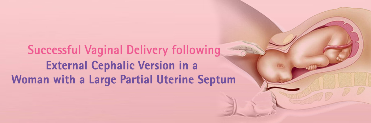 Successful Vaginal Delivery following External Cephalic Version in a Woman with a Large Partial Uterine Septum