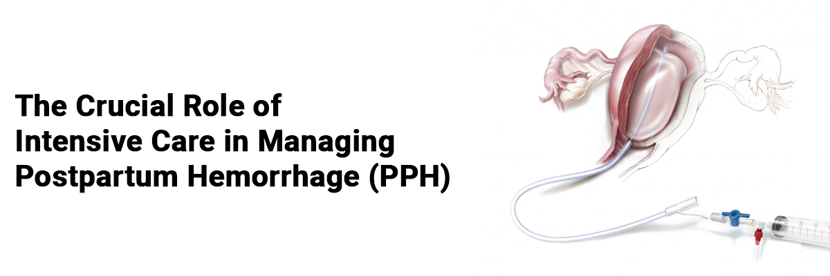 The crucial role of intensive care in managing postpartum hemorrhage (PPH)