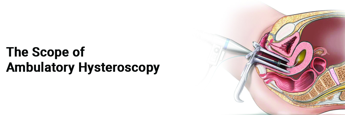 The scope of Ambulatory Hysteroscopy