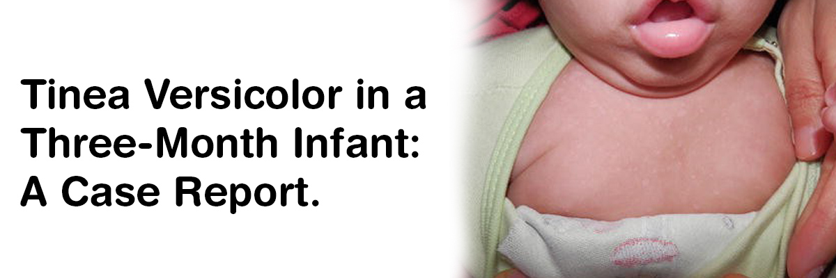Tinea Versicolor in a Three-Month Infant: A Case Report