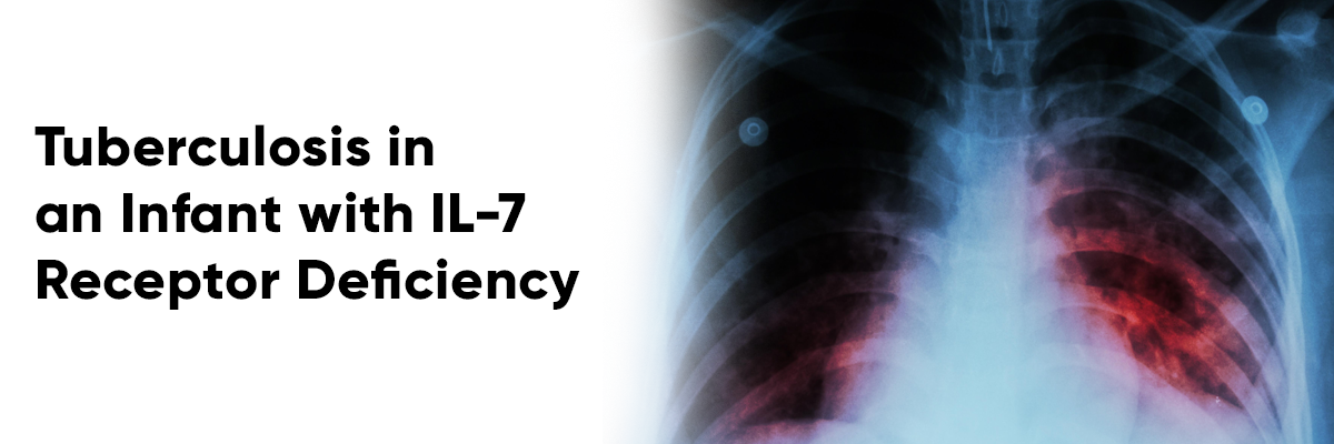 Tuberculosis in an Infant with IL-7 Receptor Deficiency