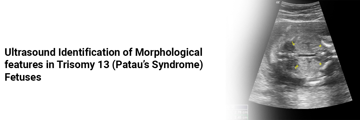 Ultrasound Identification of Morphological features in Trisomy 13 (Patau's Syndrome) Fetuses