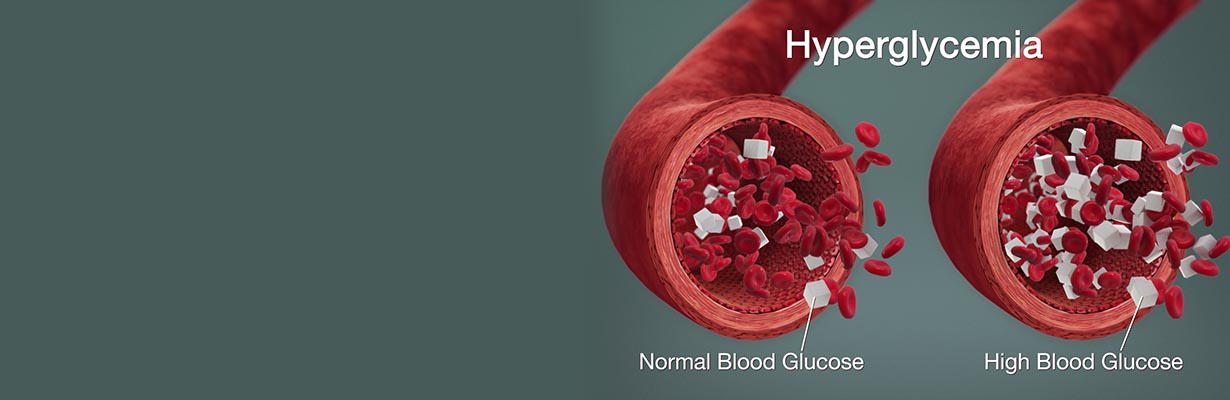 Understanding white coat hyperglycemia?