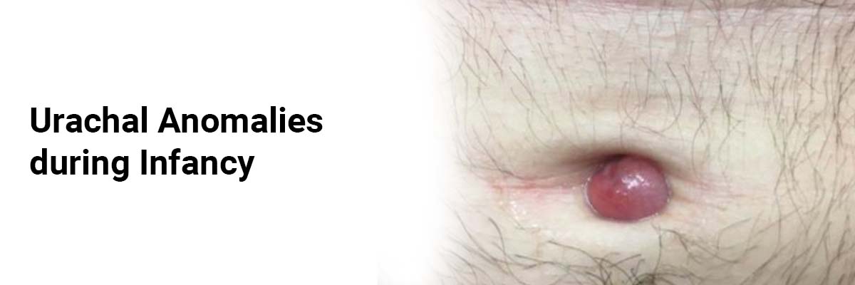 Urachal Anomalies during Infancy
