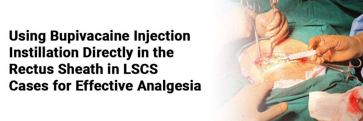 Using Bupivacaine Injection Instillation Directly in the Rectus Sheath in LSCS Cases for Effective Analgesia
