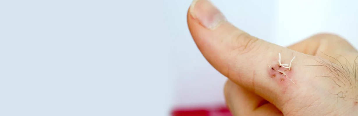 What are dissolving stitches made of? What do they dissolve in?