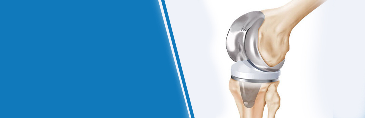 What are high flexibility implants?