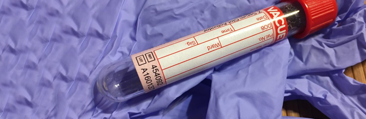 What are the blood tests for infertility?