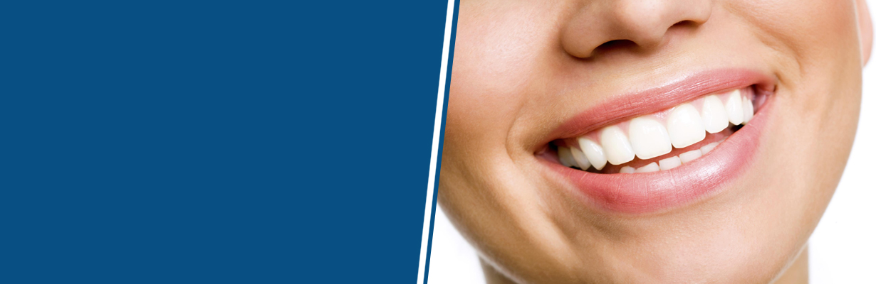 What everybody should know about dental fluorosis?