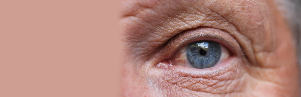 What is Age related macular Degeneration?