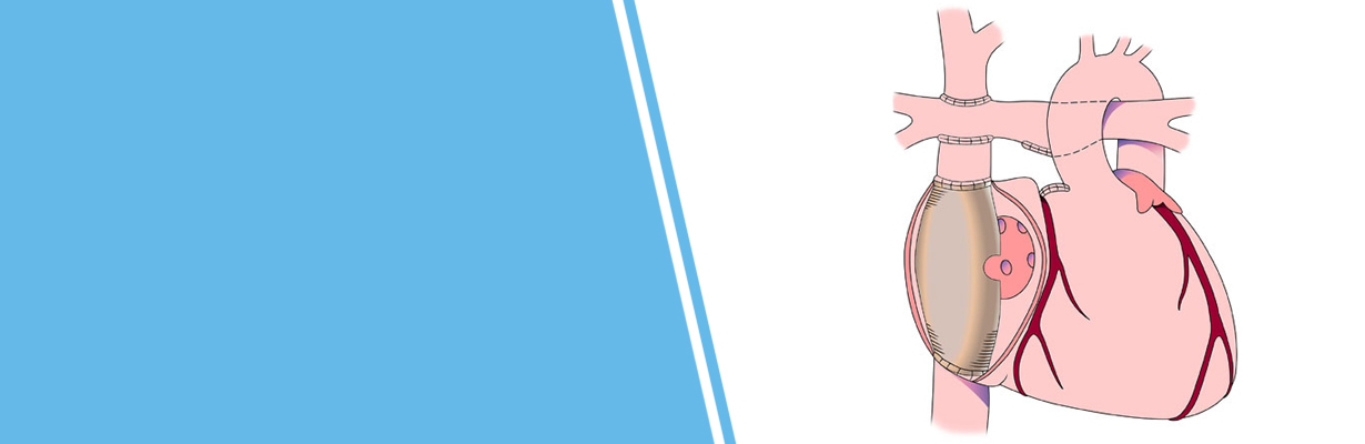 What is fenestration in fontan surgery?