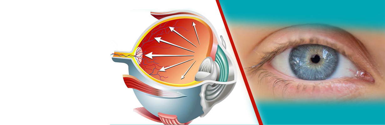 What is glaucoma and how prevalent is it?